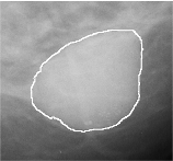 \includegraphics[width=3.5 cm]{images/massa1.eps}