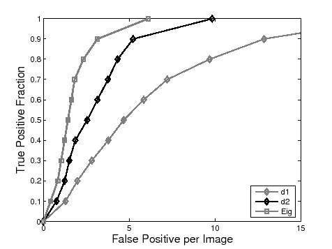 \includegraphics[width=10.5 cm]{images/frocComparison.eps}